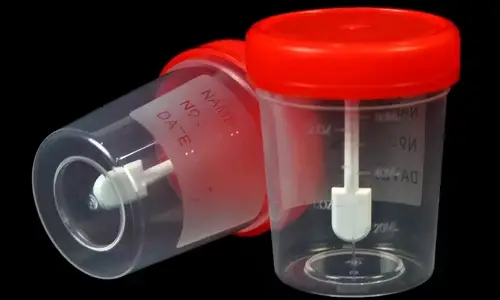 Does Stool Contain Bacteria?